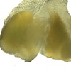 image of salivary gland